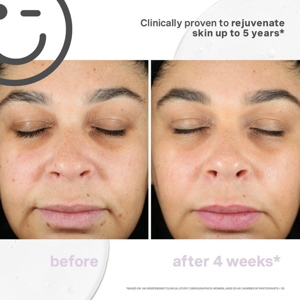 Kate Somerville KateCeuticals Supercell Rejuvenation serum, 30ml